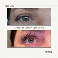 LASH AND BROW GROWTH SERUM