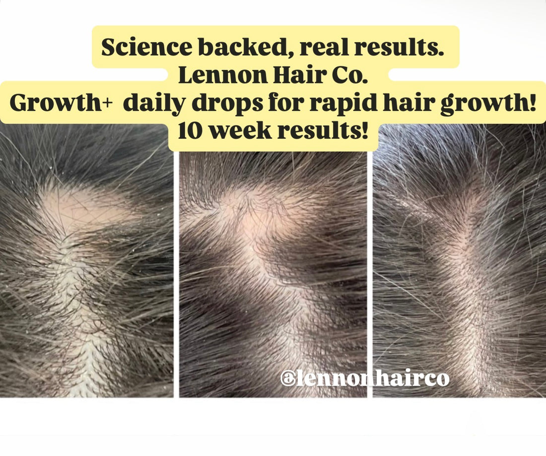 Daily Rapid Growth Drops (NEW)