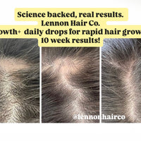 Daily Rapid Growth Drops (NEW)