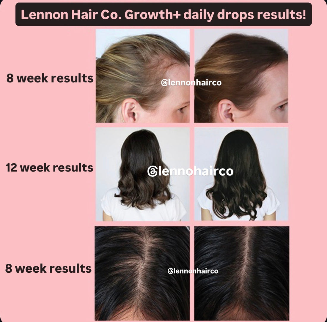 Daily Rapid Growth Drops (NEW)
